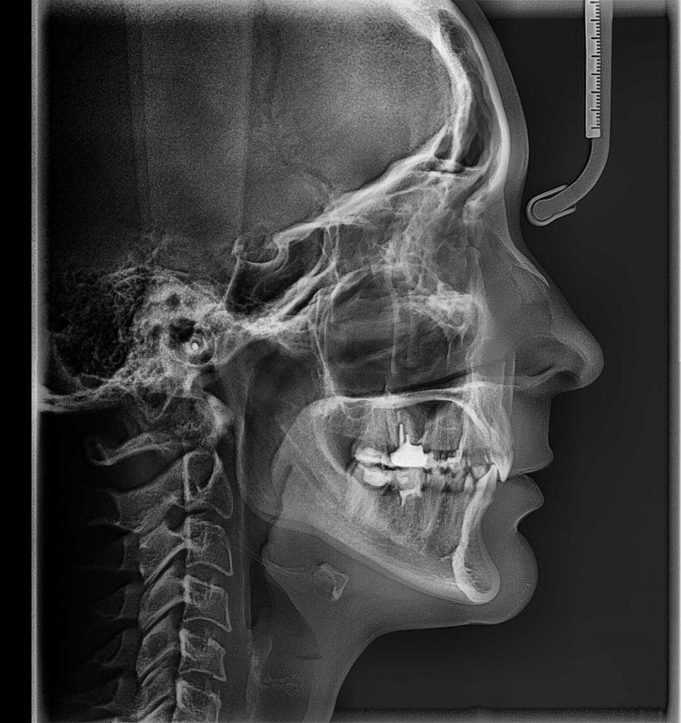 tecnología de vanguardia en Barcelona y Gavá, centro odontológico de referencia en Barcelona y Gavá, clínica dental en Barcelona y Gavá, dentista en Barcelona y Gavá.