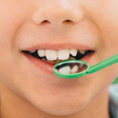 odontopediatría en Barcelona y Gavá, dentista en Barcelona y Gavá, clínica dental en Barcelona y Gavá.