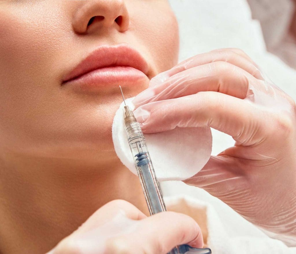 ácido hialurónico en Barcelona y Gavá, aumento de labios sin cirugía en Barcelona y Gavá, aumento de labios en Barcelona y Gavá.