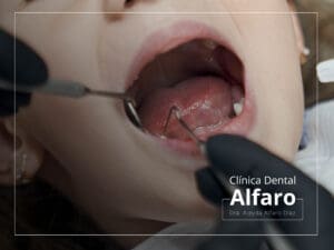 Caries infantiles
