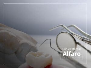 Corona dental
