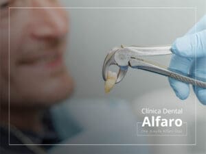 Extracción dental