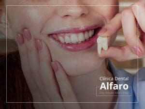 Extracción del tercer molar o muela de juicio