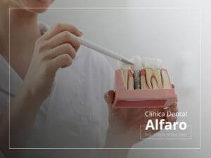 Implantología
