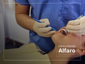 Mantenimiento periodontal