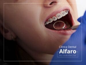 Ortodoncia infantil