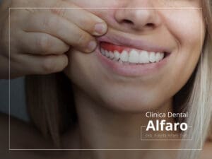 Periodoncia