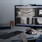 Tomografía dentoalveolar