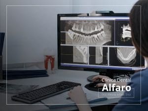 Tomografía dentoalveolar